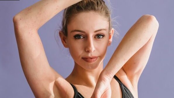 Painful hair: 8 reasons for pain in the nipple